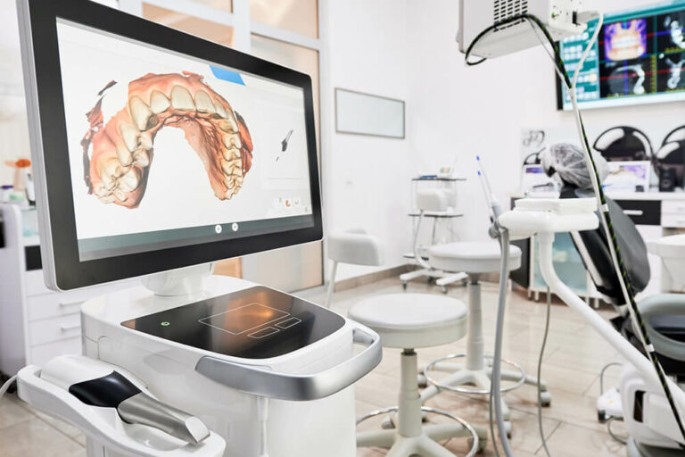 CEREC Scanner machine showing 3D scan of mouth
